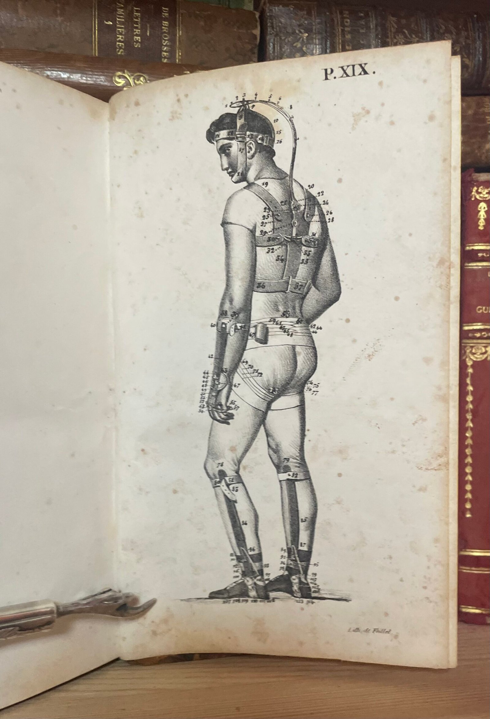 Traité des bandages et appareils de pansement par P. N. Gerdy Paris chez Crevot 1826 - immagine 16