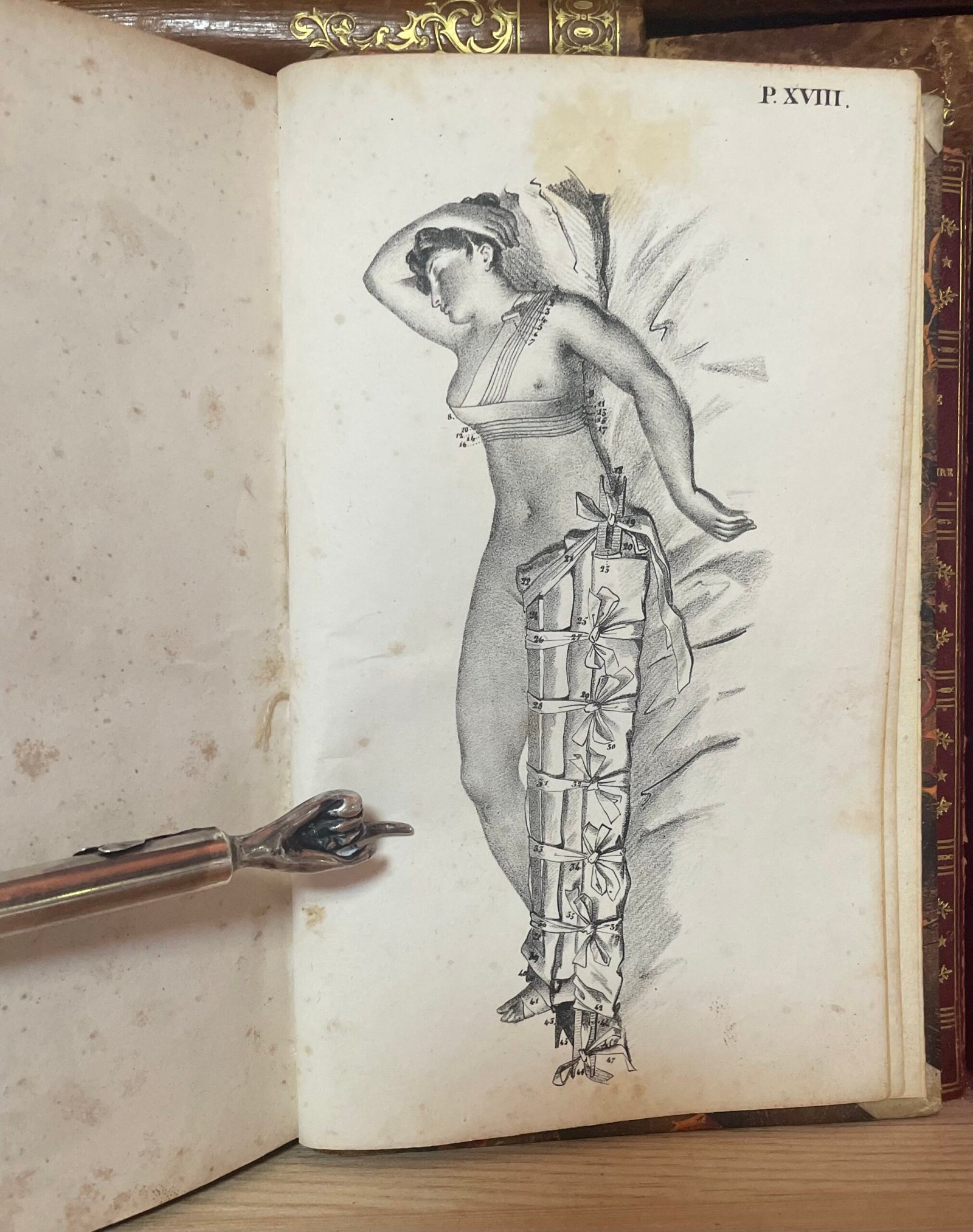 Traité des bandages et appareils de pansement par P. N. Gerdy Paris chez Crevot 1826 - immagine 17