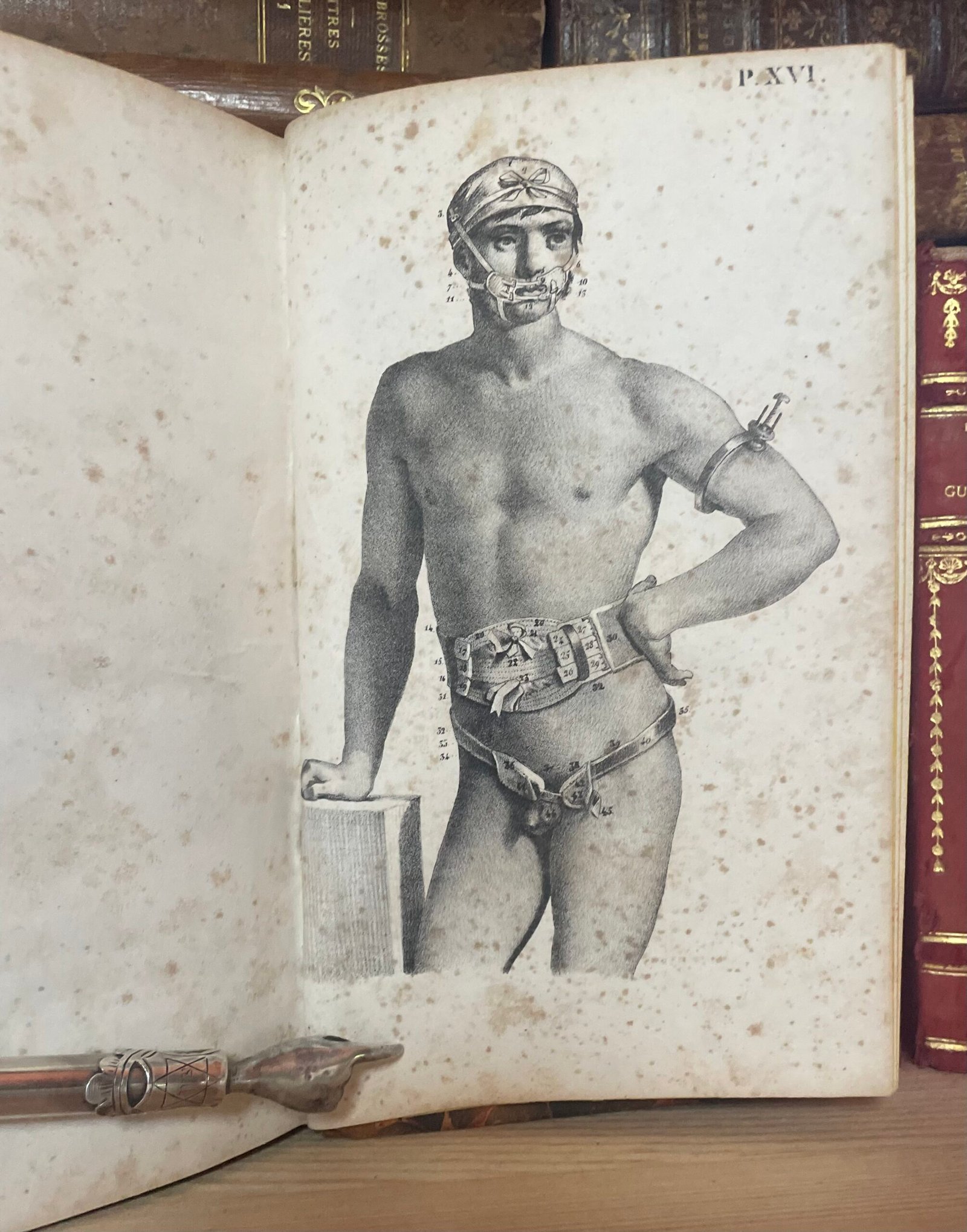 Traité des bandages et appareils de pansement par P. N. Gerdy Paris chez Crevot 1826 - immagine 19