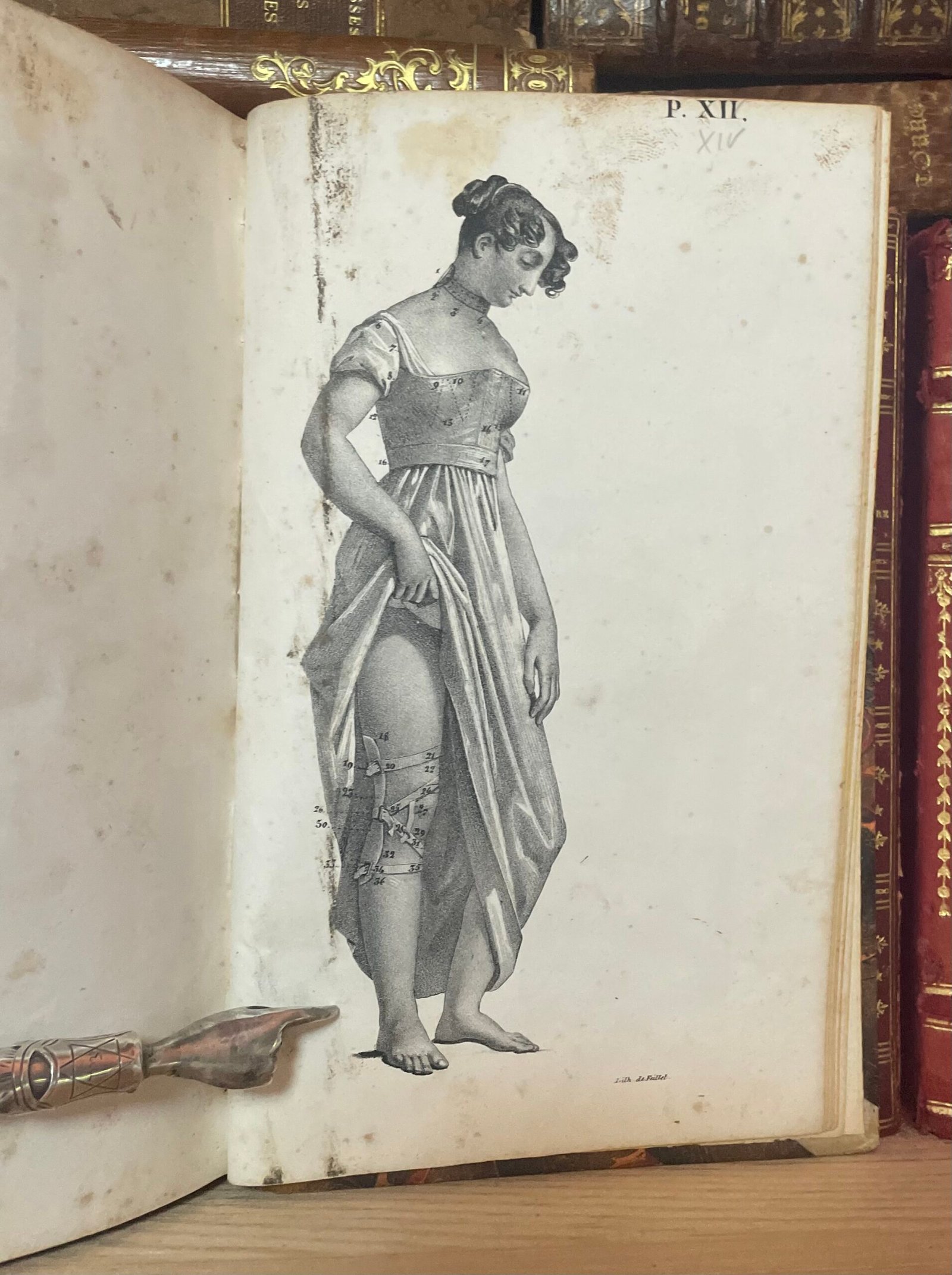Traité des bandages et appareils de pansement par P. N. Gerdy Paris chez Crevot 1826 - immagine 20