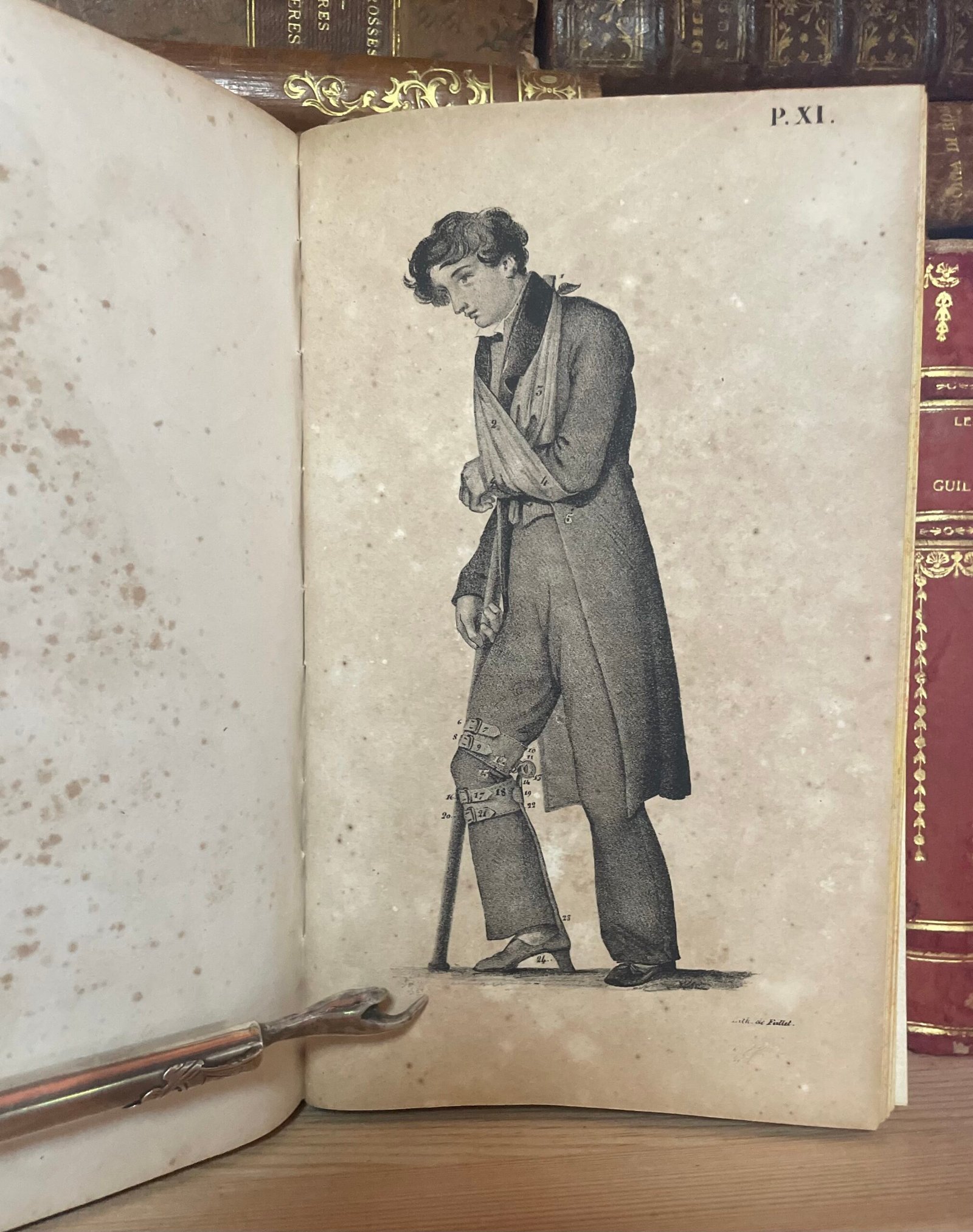 Traité des bandages et appareils de pansement par P. N. Gerdy Paris chez Crevot 1826