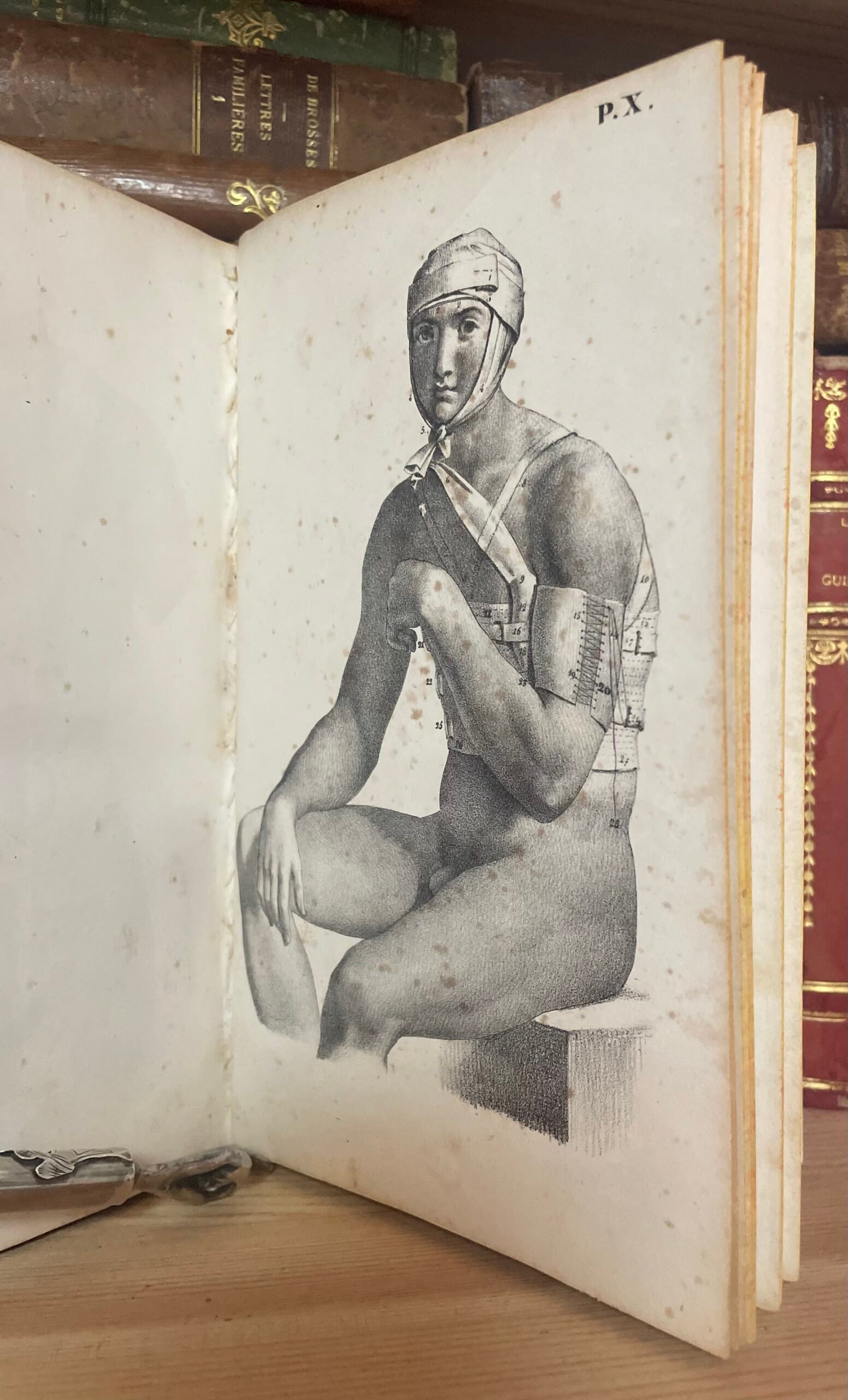 Traité des bandages et appareils de pansement par P. N. Gerdy Paris chez Crevot 1826 - immagine 23