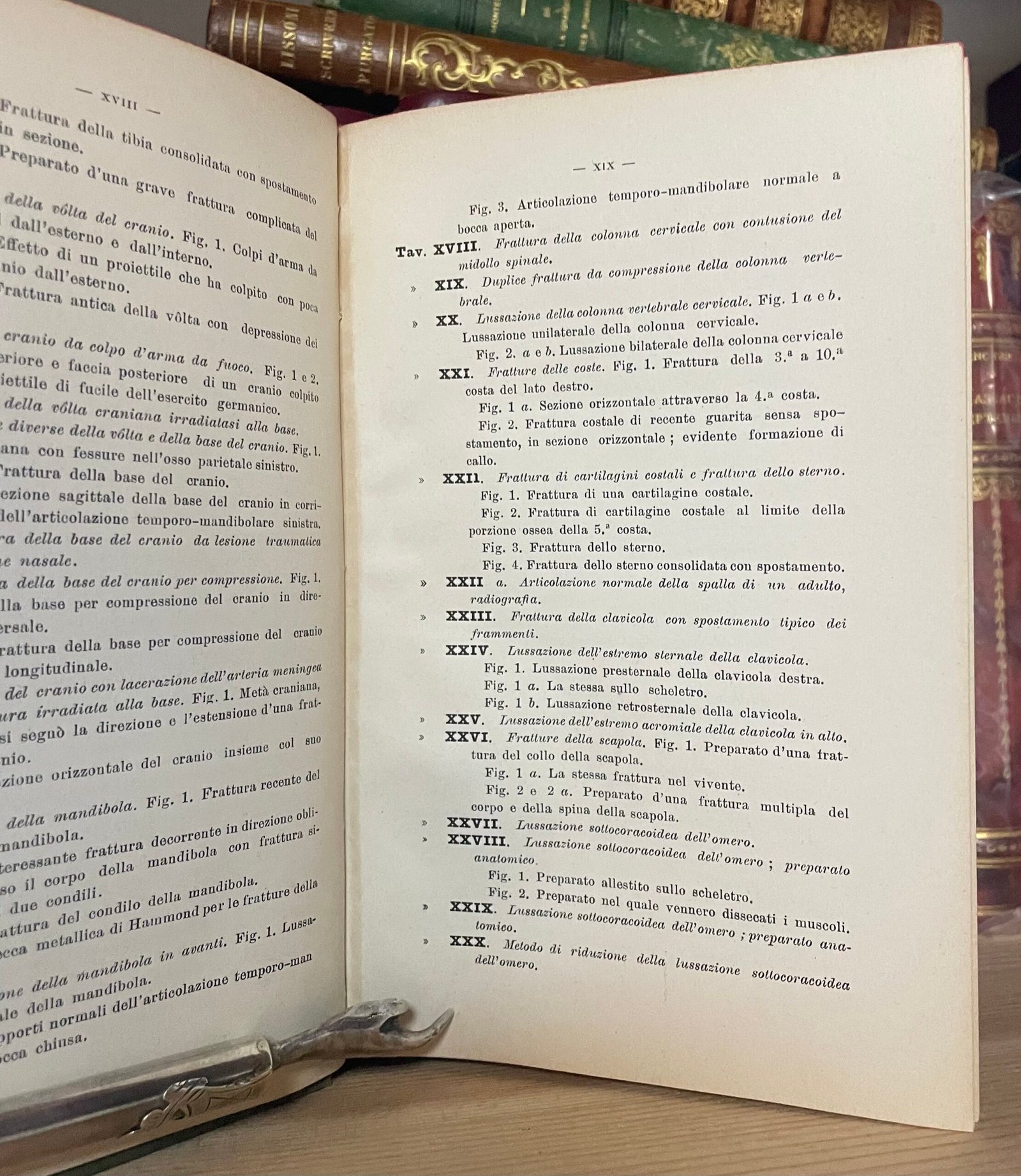 Helferich Atlante e compendio delle fratture e lussazioni traumatiche 1908 - immagine 12