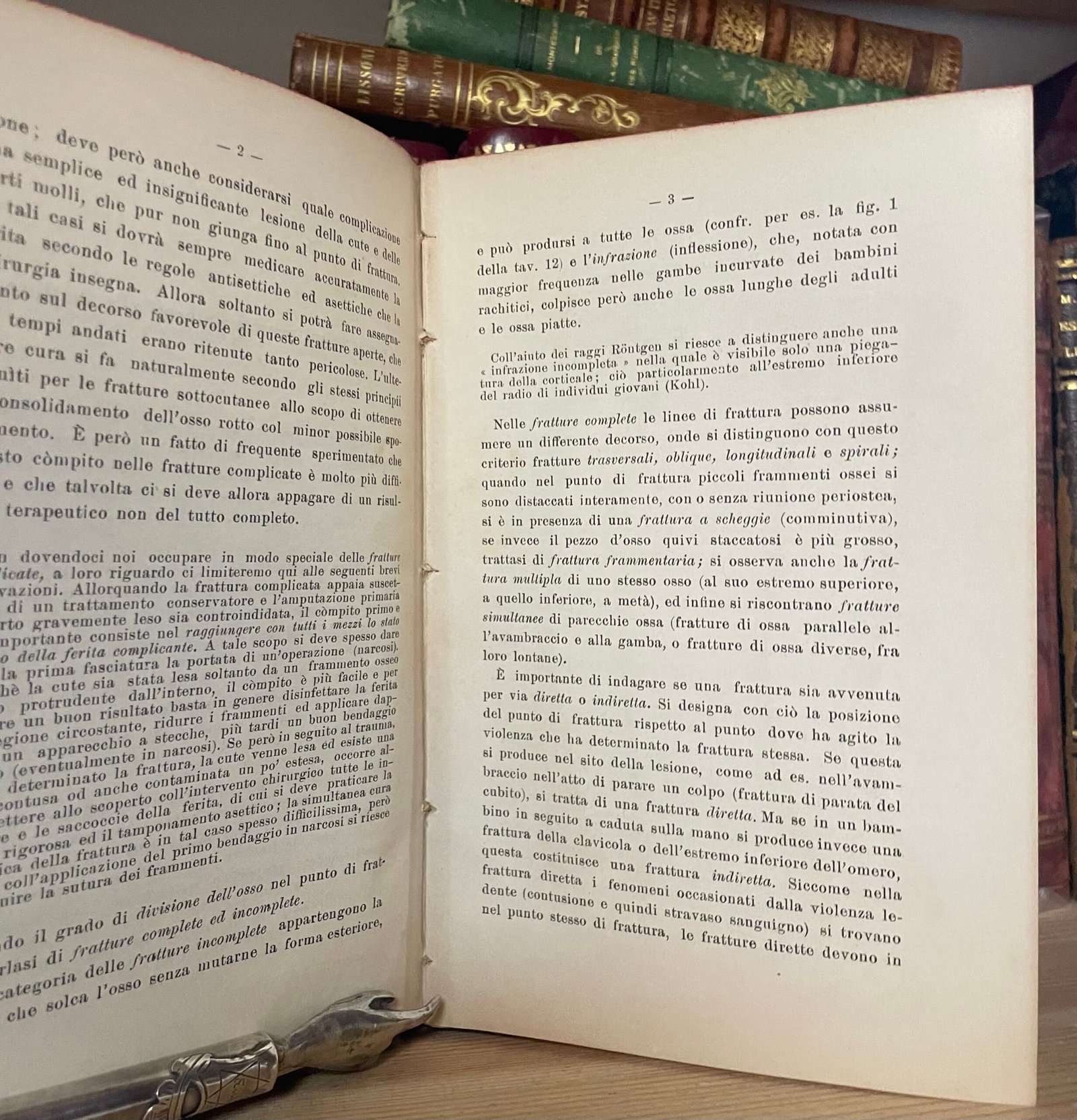 Helferich Atlante e compendio delle fratture e lussazioni traumatiche 1908 - immagine 13