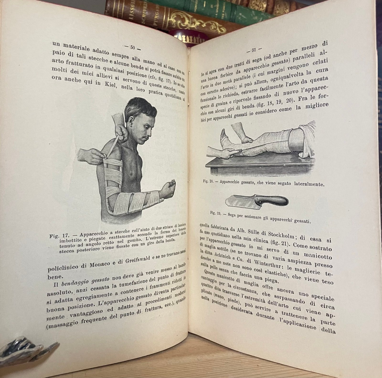 Helferich Atlante e compendio delle fratture e lussazioni traumatiche 1908 - immagine 22