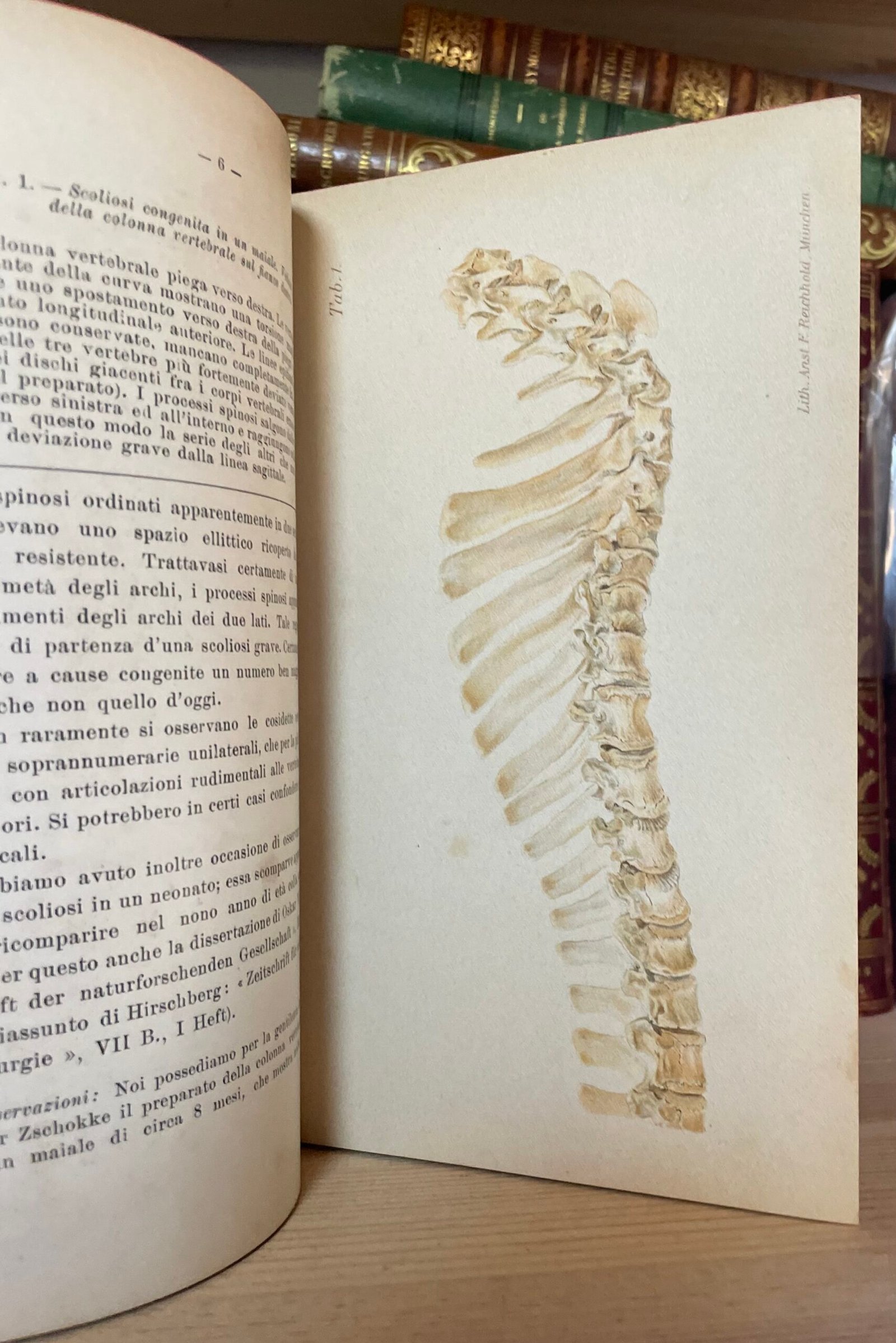 Condividi Atlante e compendio di Chirurgia Ortopedica per studenti e medici 1902 - immagine 5