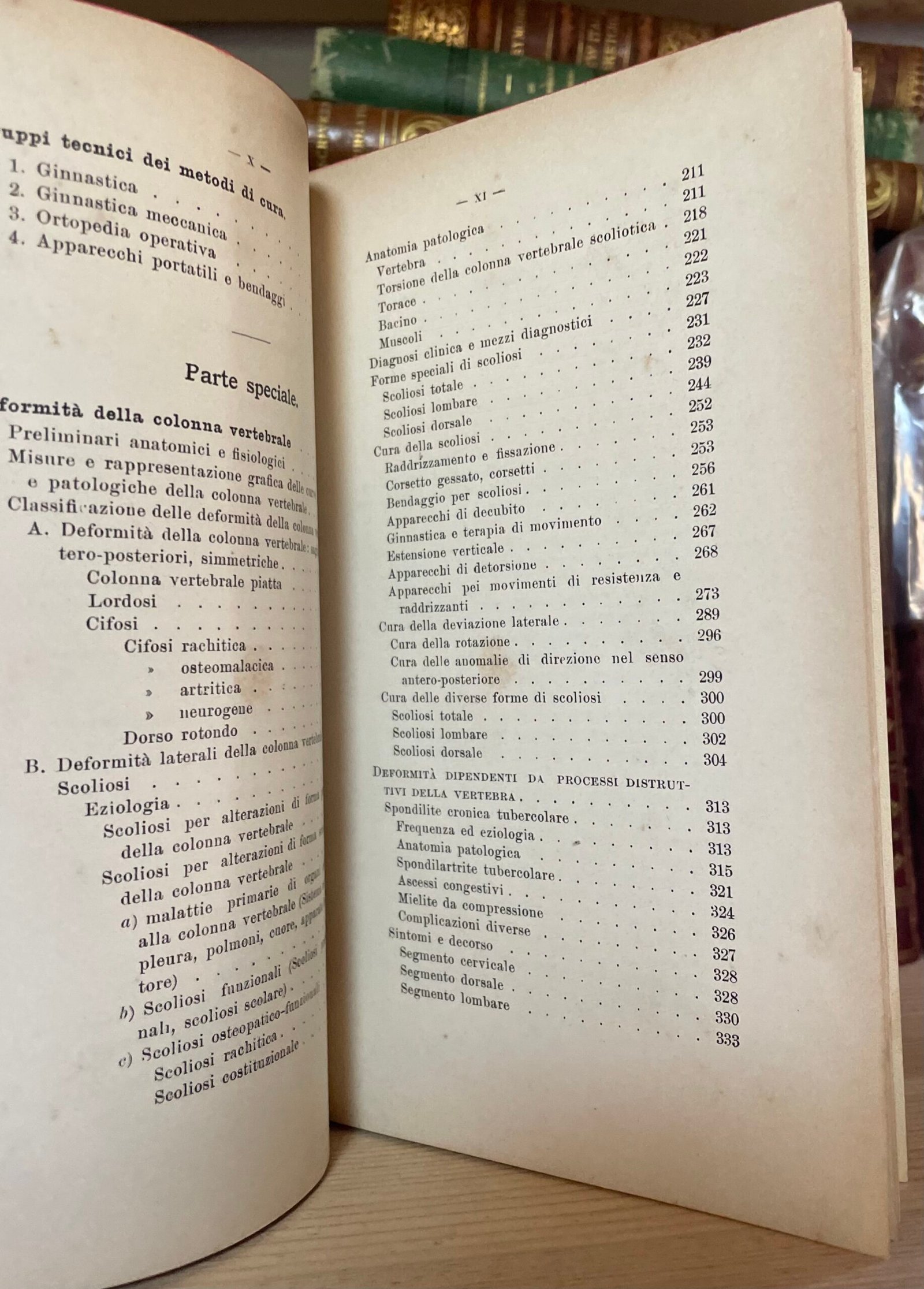 Condividi Atlante e compendio di Chirurgia Ortopedica per studenti e medici 1902 - immagine 6