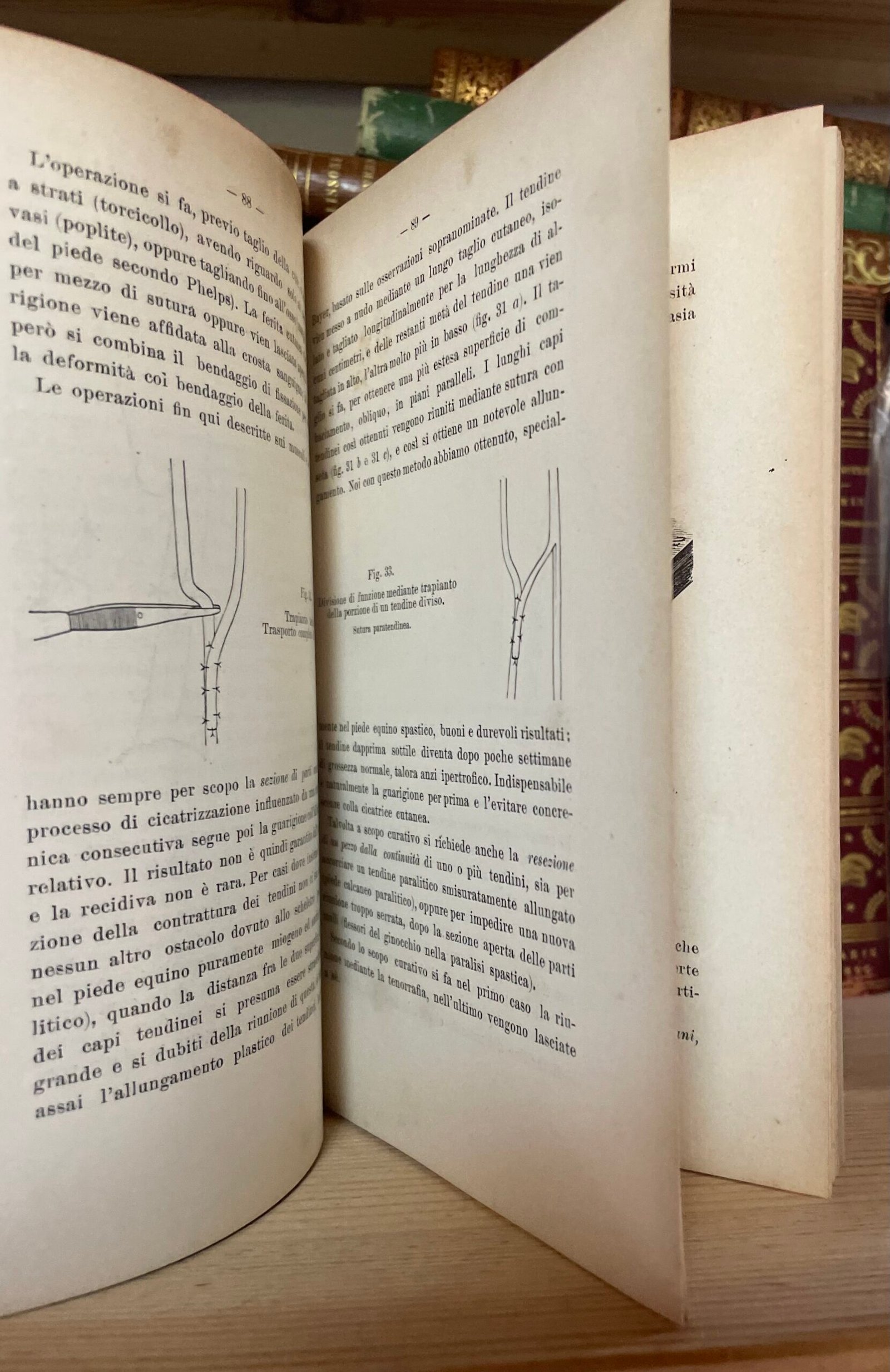 Condividi Atlante e compendio di Chirurgia Ortopedica per studenti e medici 1902 - immagine 7