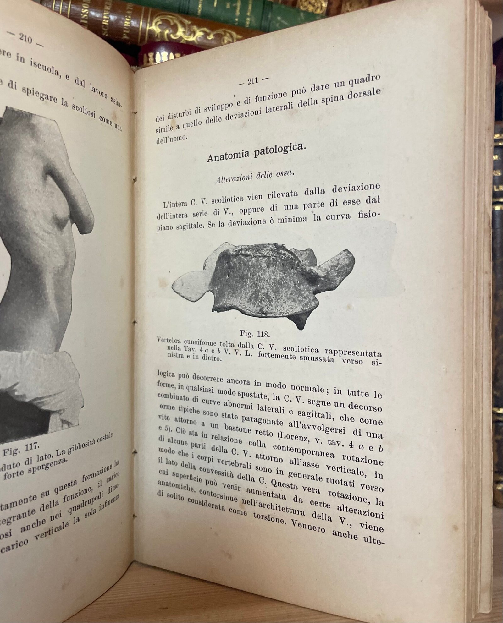 Condividi Atlante e compendio di Chirurgia Ortopedica per studenti e medici 1902 - immagine 9