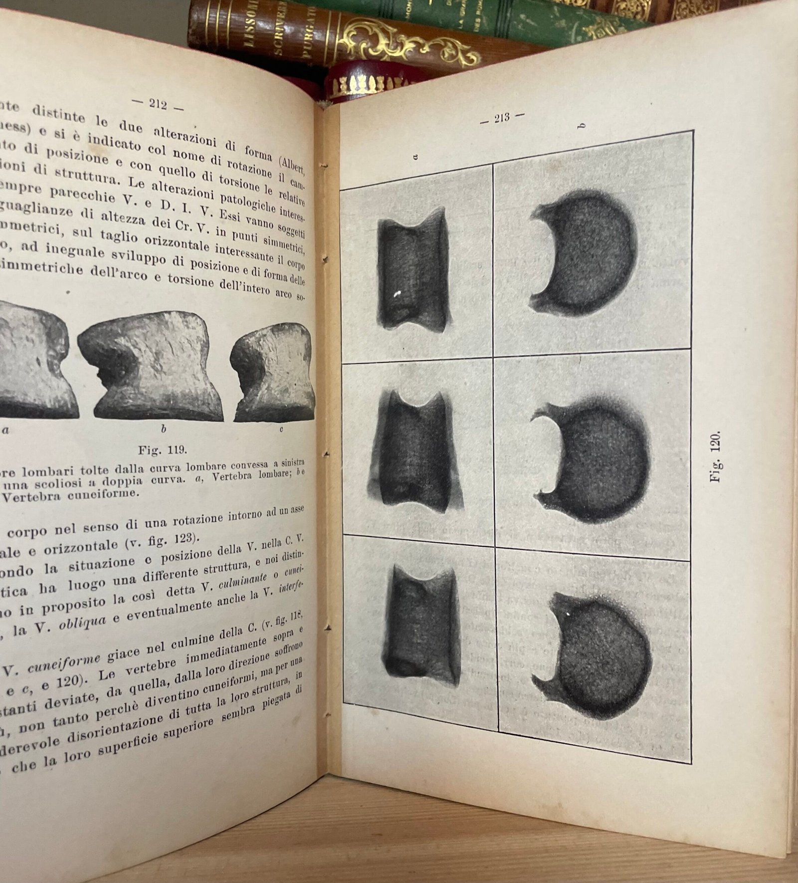 Condividi Atlante e compendio di Chirurgia Ortopedica per studenti e medici 1902 - immagine 10