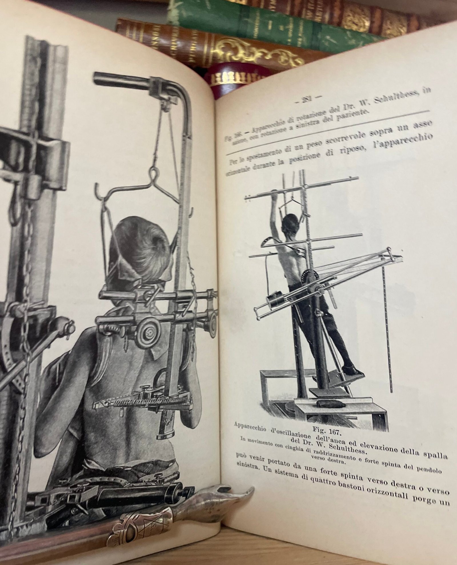 Condividi Atlante e compendio di Chirurgia Ortopedica per studenti e medici 1902 - immagine 11
