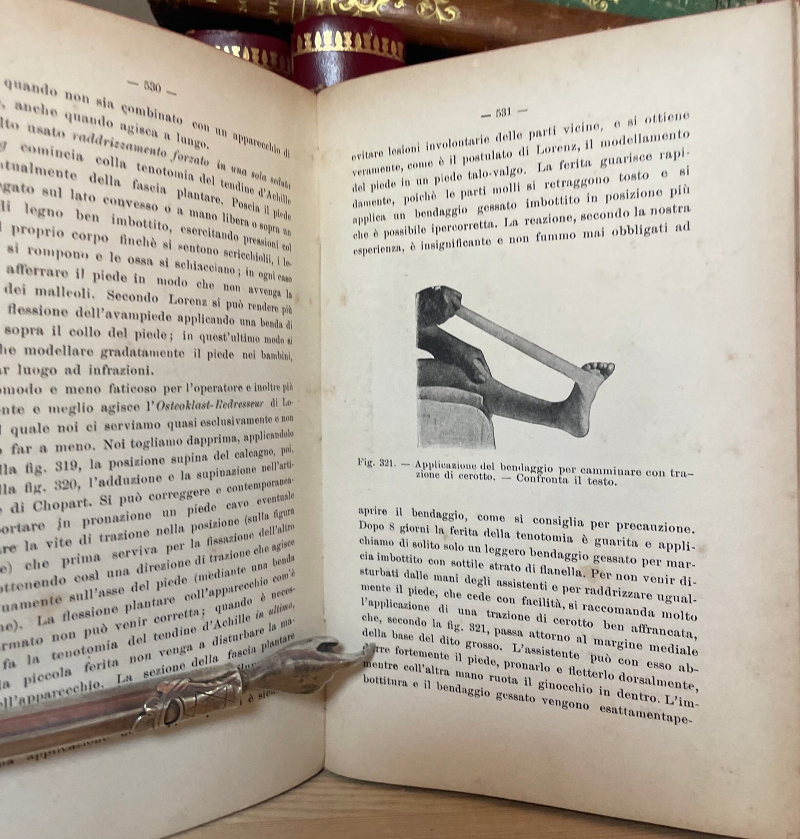 Condividi Atlante e compendio di Chirurgia Ortopedica per studenti e medici 1902 - immagine 12