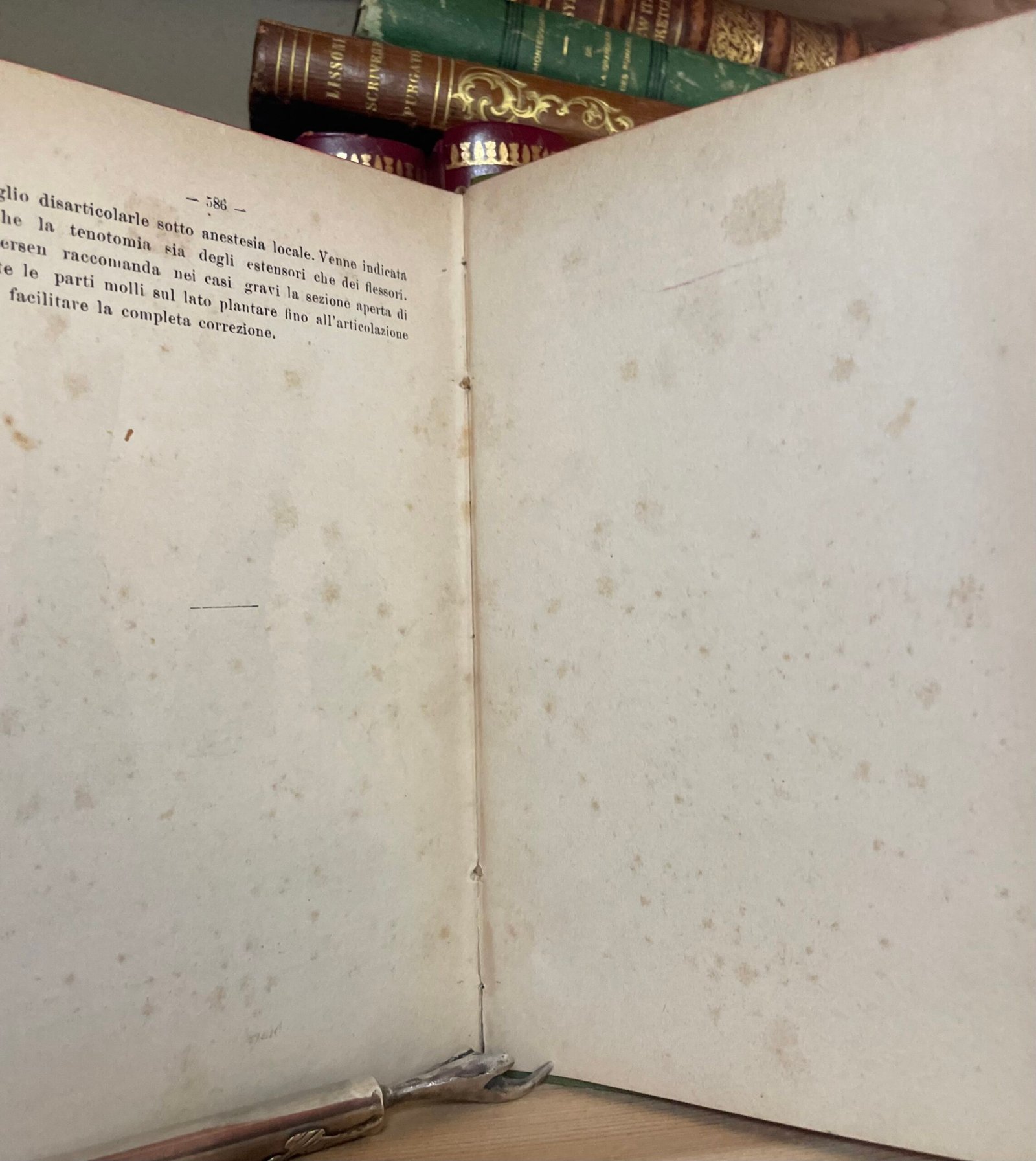 Condividi Atlante e compendio di Chirurgia Ortopedica per studenti e medici 1902 - immagine 13